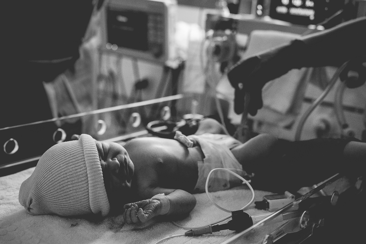 bébé juste après la cesarienne